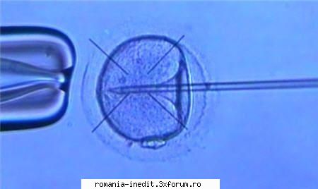 bbc science nature horizon cloning the first human dvdrip, panayiotis zavos and severino antinori