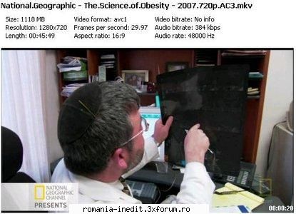 National Geographic - The Science of Obesity (2007) - National Geographic - The Science - Filme Documentare
