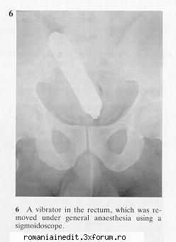Radiografii funny - Ivantu - Funny