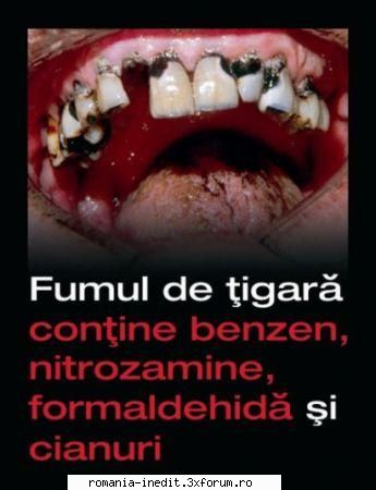 fumatul !!! - cu tot respectul, dar imi va fi greu sa ma apuc - Off Topic
